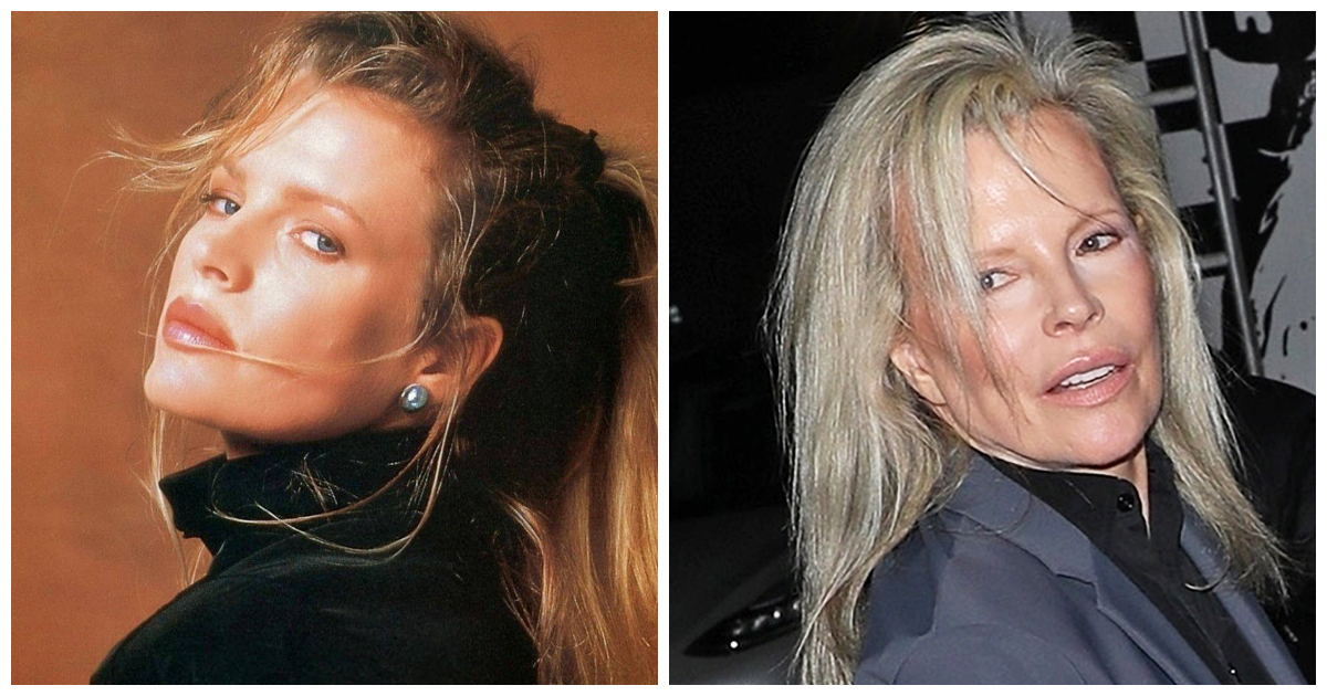 At 71, The Tragedy Of Kim Basinger Is Beyond Heartbreaking